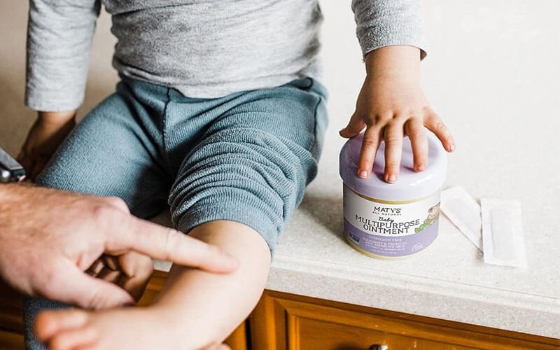 Matys natural multipurpose baby ointment