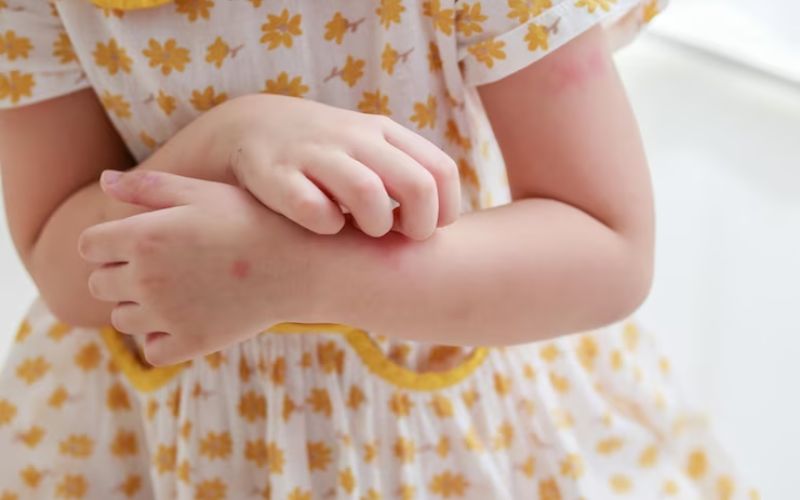 General Skin Irritation